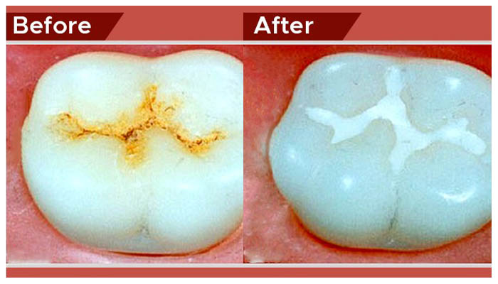 pediatric dentist in Abu Dhabi